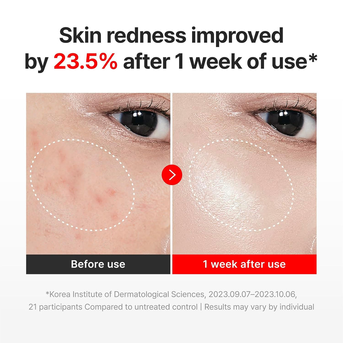 Centellian24 Madeca Cream Time Reverse — Two 50ml Tubes